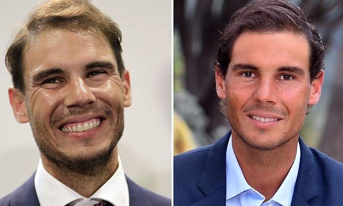 nadal-injertos-cambio.jpg