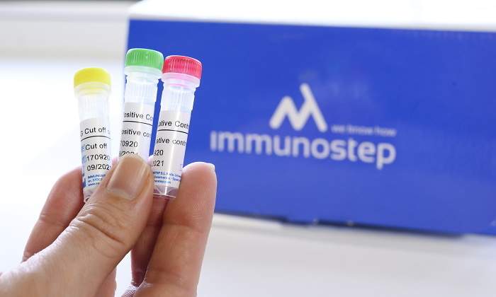 test-serologico-csic.jpg