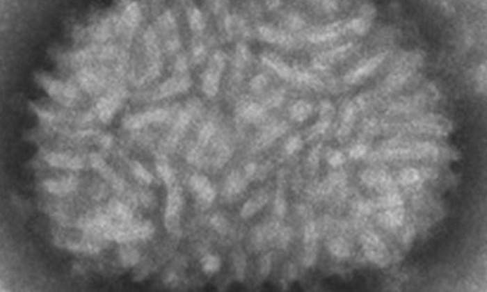 virus-viruela-csic.jpg