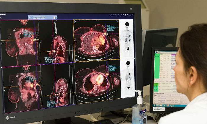 mama-cancer-medico-ordenador-alamy.jpg