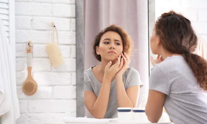 acne-70.jpg