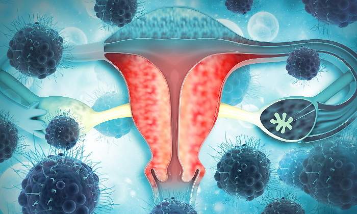 cancer-cuello-de-utero.jpg