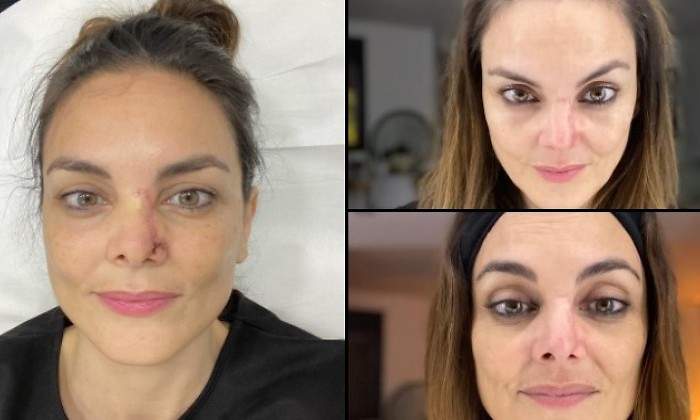 monica-carrillo-carcinoma.jpg