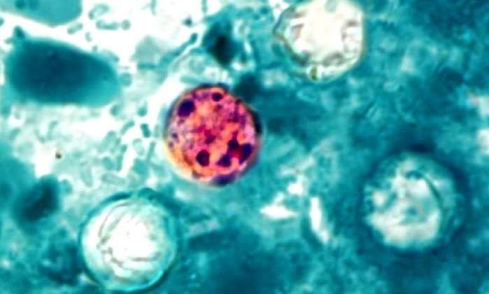Cyclospora-cayetanensis.jpg