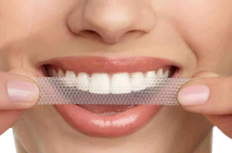Tiras blanqueadoras dentales