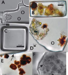 bacterias-sal-GSA.jpg