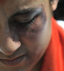 El PP reformará la Ley contra la violencia de género