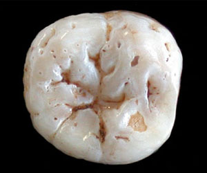 El diente del viajero Neandertal