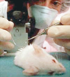 Estudian anticuerpos que protegen contra la infección por VIH