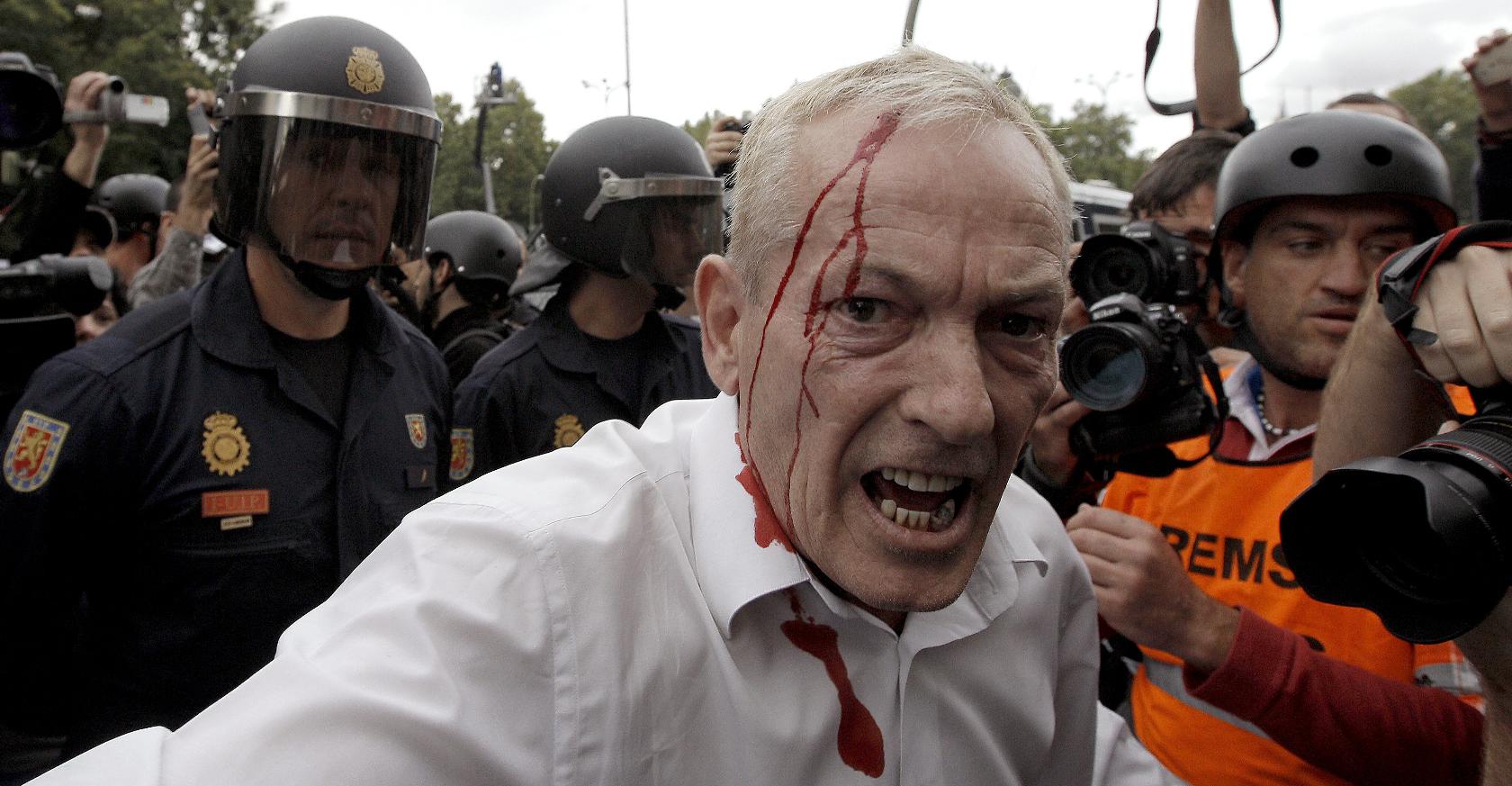 Herido en el 25-S
